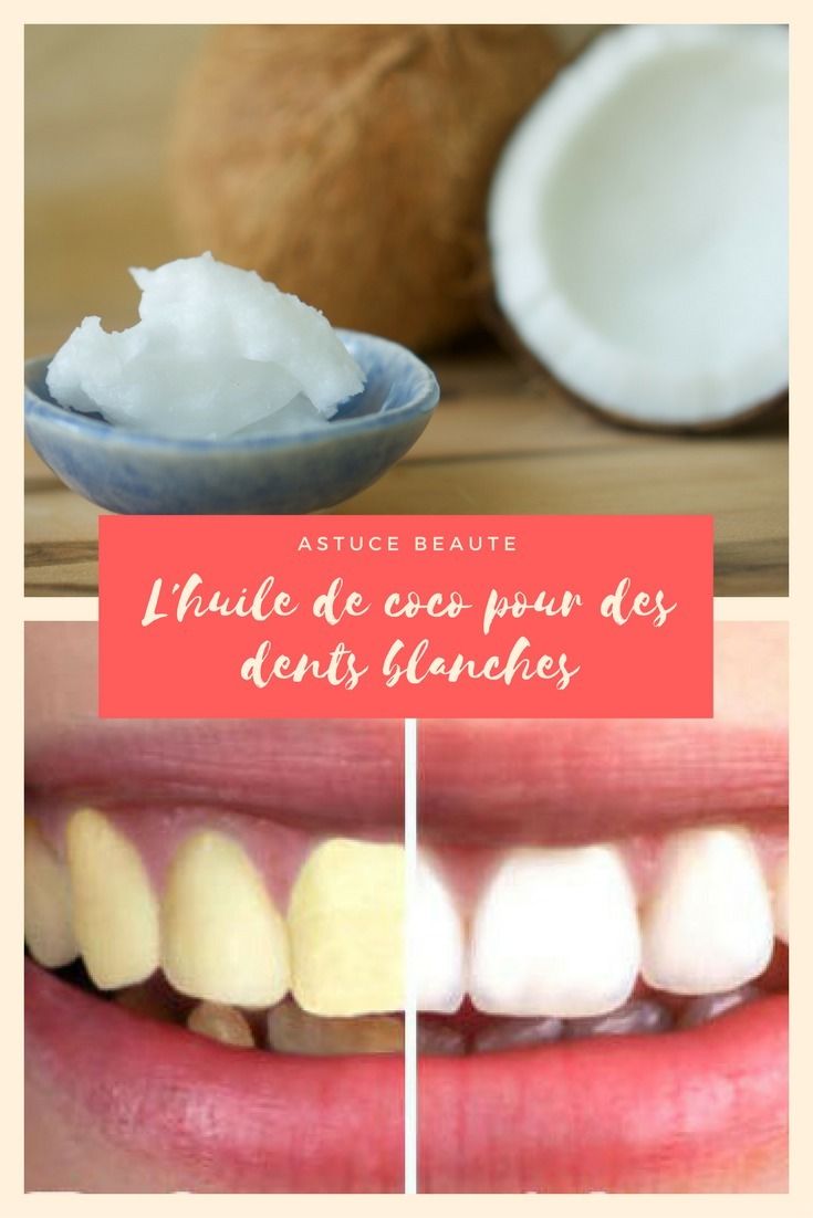 découvrez des méthodes efficaces et naturelles pour blanchir vos dents sans produits chimiques. astuces, remèdes maison et conseils pour retrouver un sourire éclatant en toute sécurité.