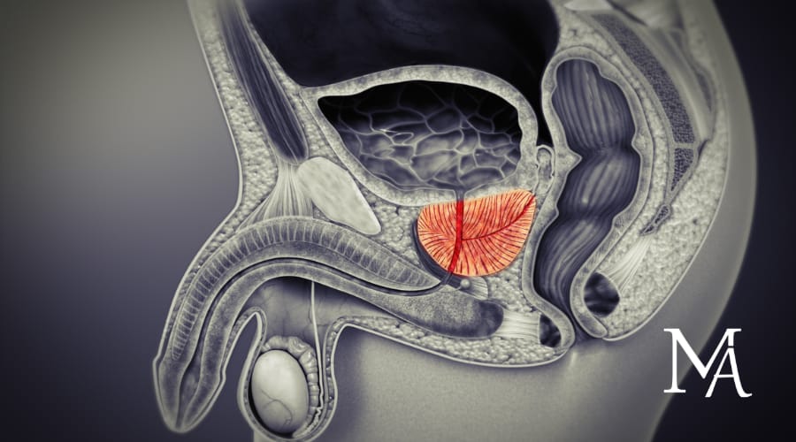 découvrez comment bien préparer une échographie de la prostate pour un examen précis et confortable. conseils et étapes essentiels avant votre rendez-vous médical.